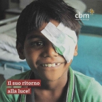 operazione cataratta bambino
