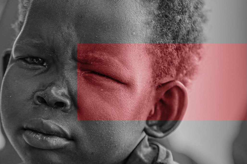 bambino con disabilità visiva