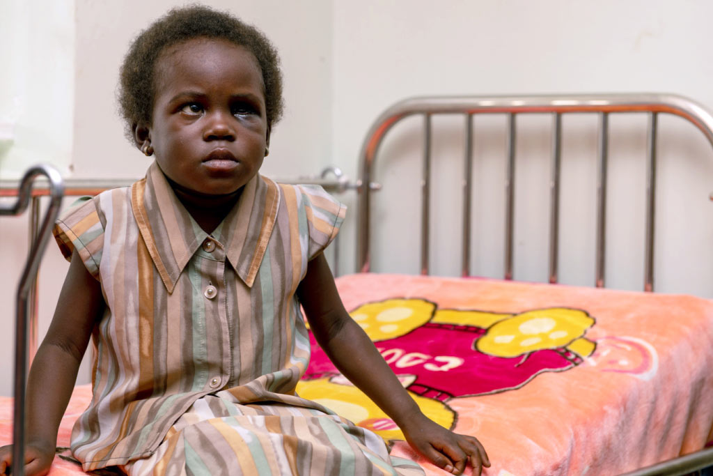 primo piano di Ruth con tumore all'occhio