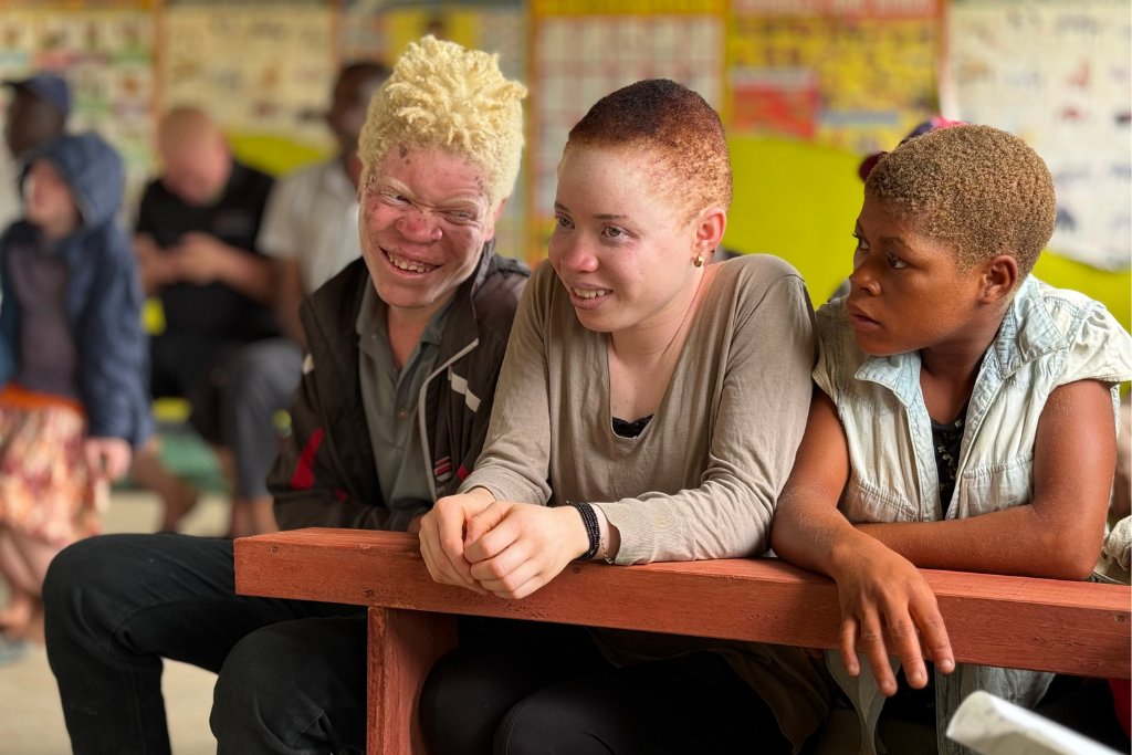 gruppo di persone albine sorridenti