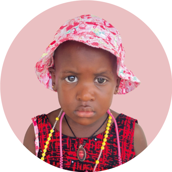 bambina con retinoblastoma seduta in area giochi