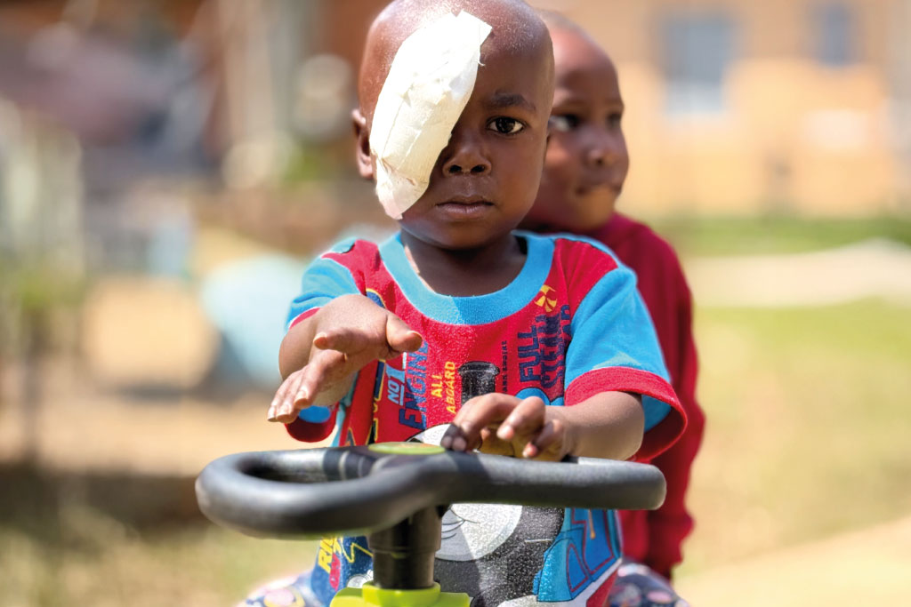 bambino con benda su occhio