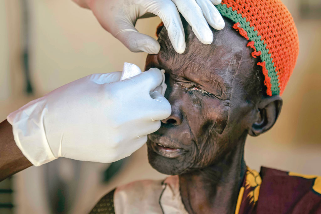 persona riceve medicazione all'occhio